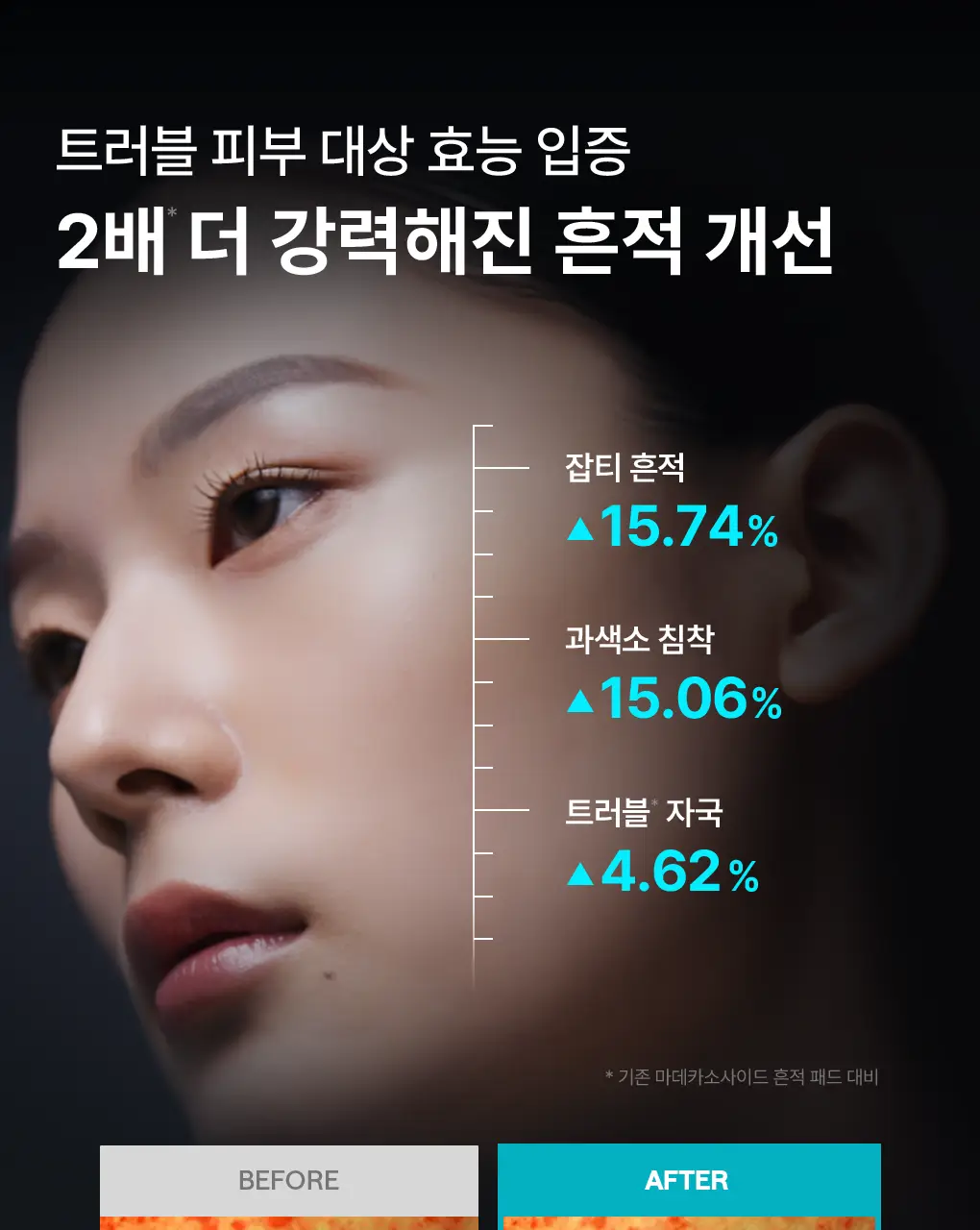[76관왕 No.1] 메디힐 더마 패드 100매 7종 피부 고민별 골라담기 상세페이지 13